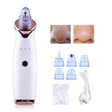 Backhead Vaccum Removal Hot Trending Deal 